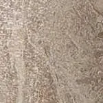 Вставка 610090000765 Privilege Grigio Bottone Lapp 7.2х7.2