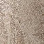 Вставка 610090000765 Privilege Grigio Bottone Lapp 7.2х7.2